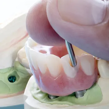 https://www.dantechdentallab.com/wp-content/uploads/2023/10/Conventional-partial-dentures.webp